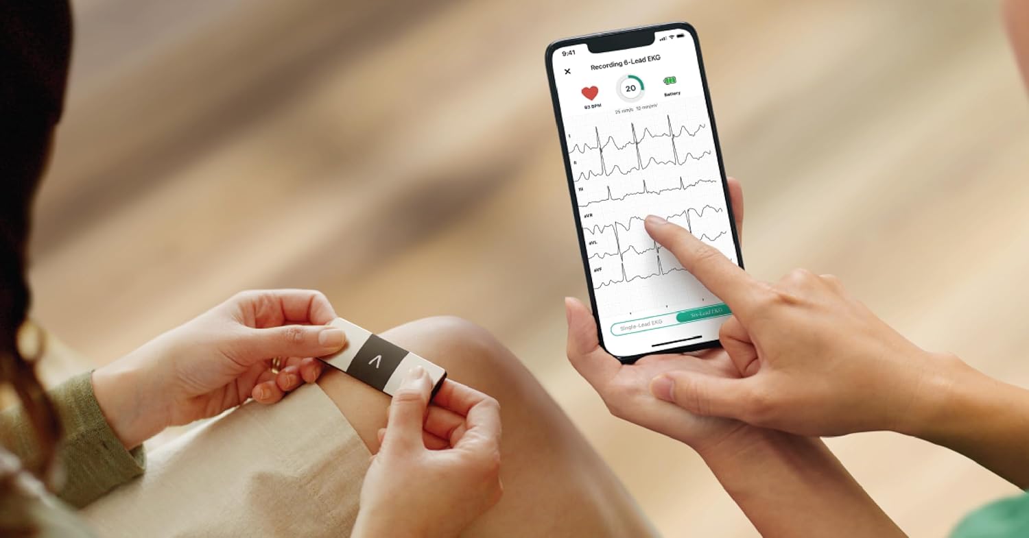 KardiaMobile 6-Lead Personal EKG Monitor – Six Views of The Heart – Detects AFib and Irregular Arrhythmias – Instant Results in 30 Seconds – Works with Most Smartphones - FSA/HSA Eligible